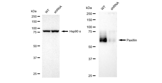 [KD Validated] Anti-PXN Rabbit mAb [89F34C75]
