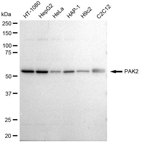 [KD Validated] Anti-PAK2 Rabbit mAb [17H62C32]