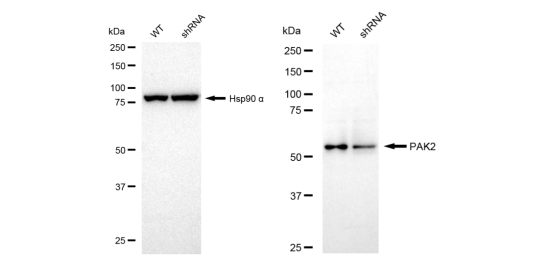 [KD Validated] Anti-PAK2 Rabbit mAb [17H62C32]