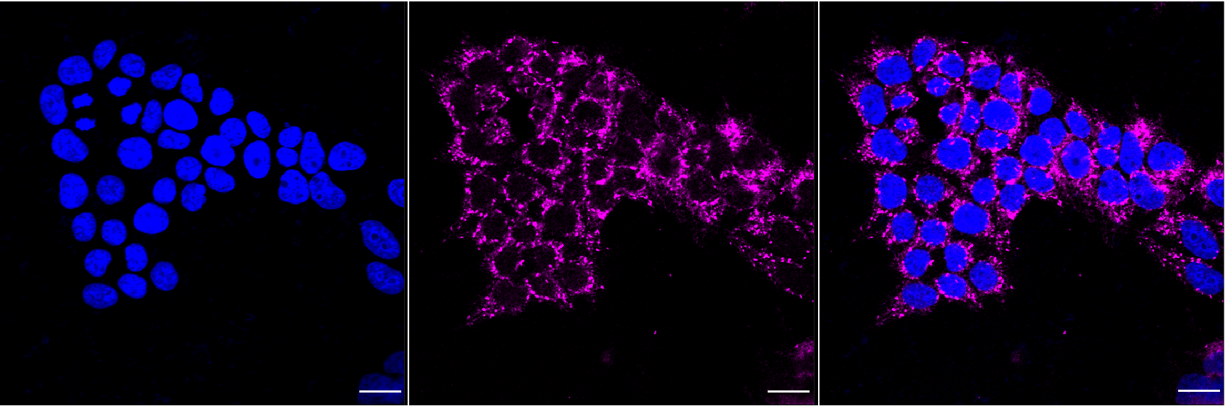 [KD Validated] Anti-FURIN Rabbit mAb [51C11B65]