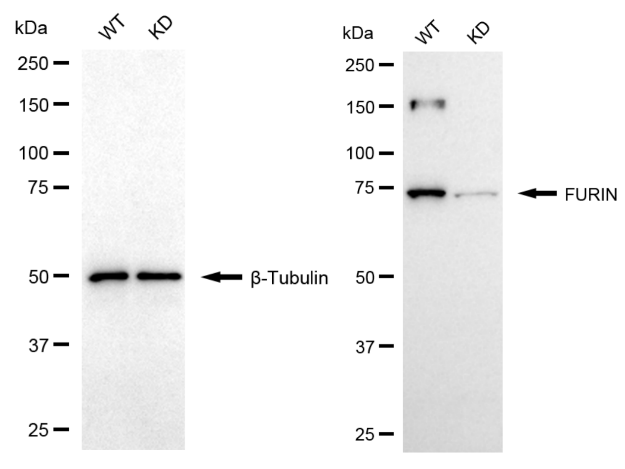 [KD Validated] Anti-FURIN Rabbit mAb [51C11B65]
