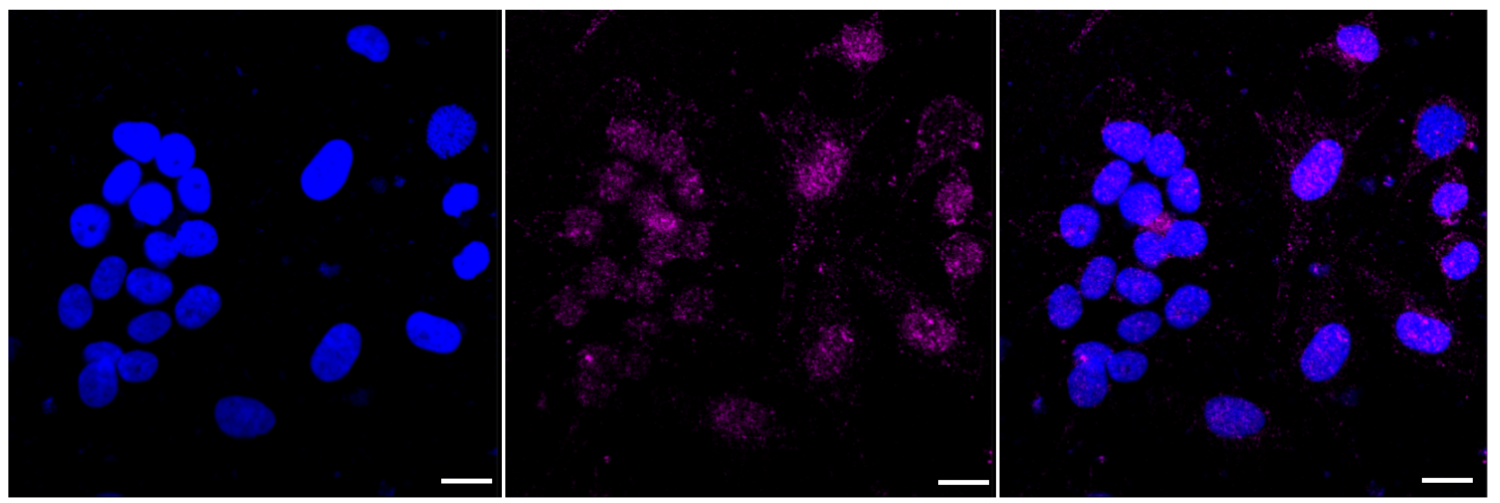 [KD Validated] Anti-MAP3K7 Rabbit mAb [81S46L64]