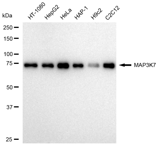 [KD Validated] Anti-MAP3K7 Rabbit mAb [81S46L64]
