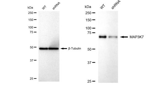 [KD Validated] Anti-MAP3K7 Rabbit mAb [81S46L64]