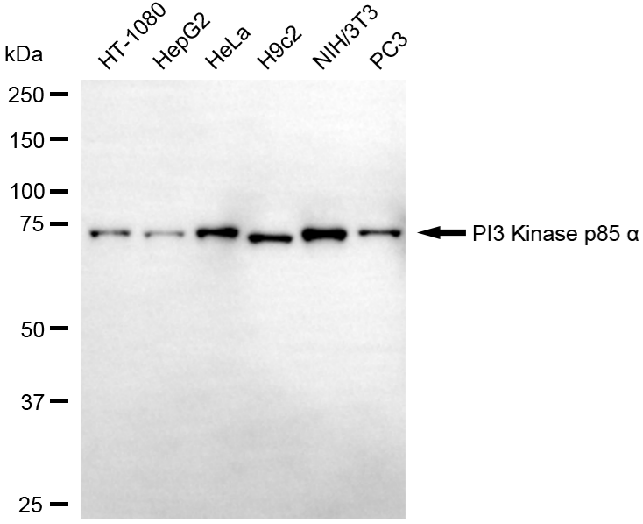[KD Validated] Anti-PIK3R1 Rabbit mAb [79G03D56]