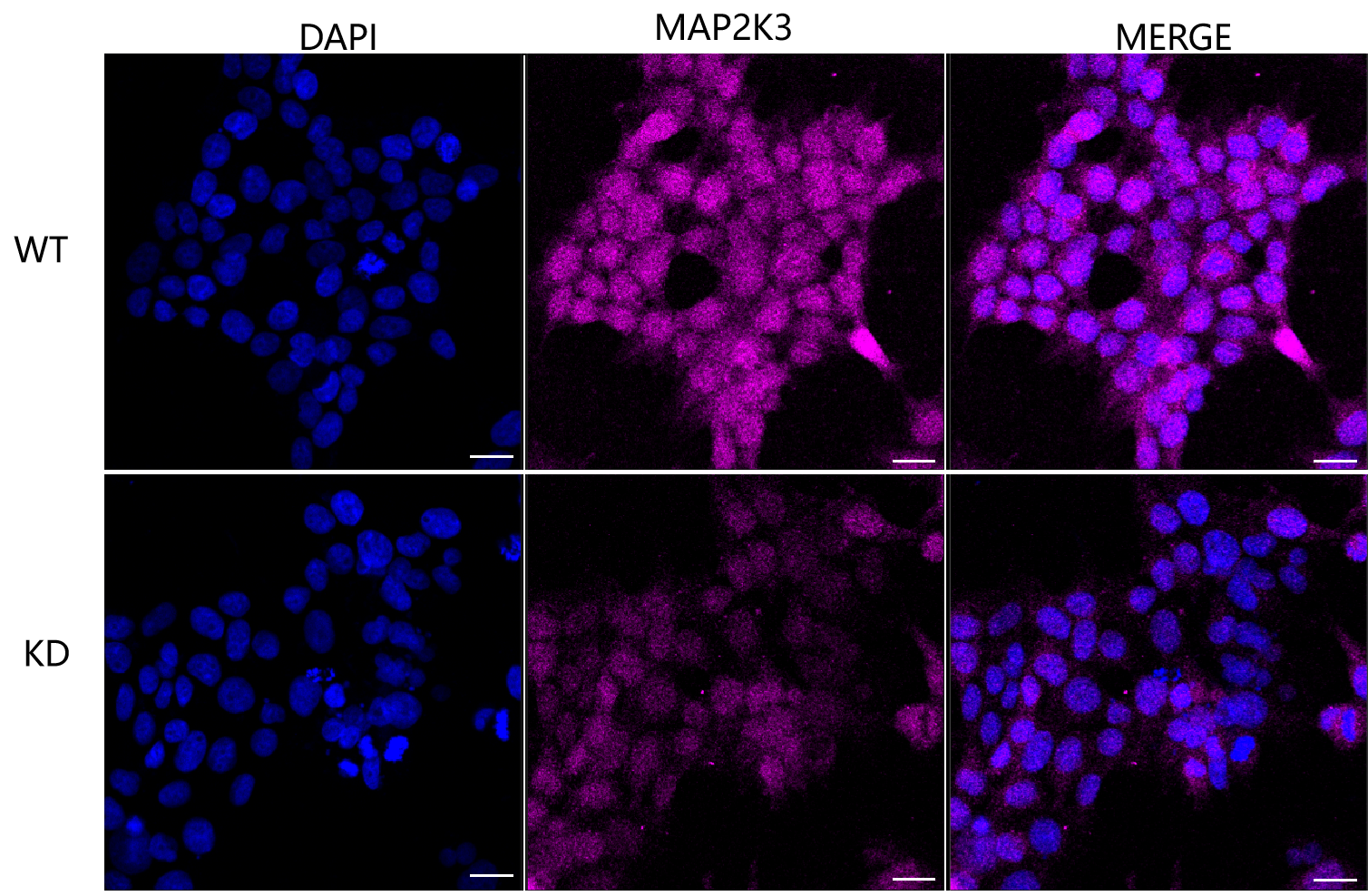 [KD Validated] Anti-MAP2K3 Rabbit mAb [95B96E02]