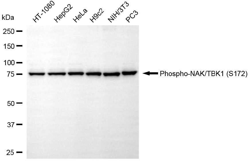 [KD Validated] Anti-TBK1 Rabbit mAb [25A29S35]
