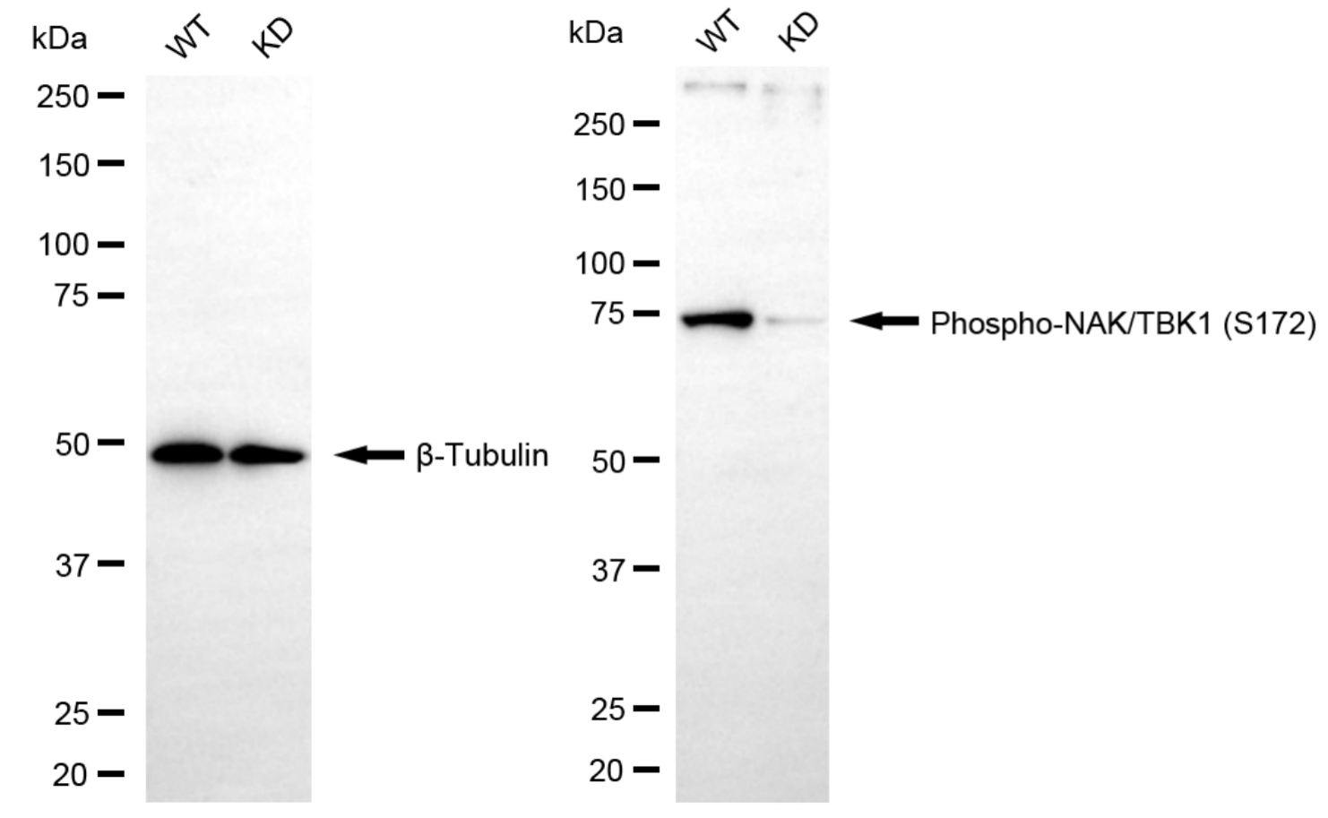 [KD Validated] Anti-TBK1 Rabbit mAb [25A29S35]