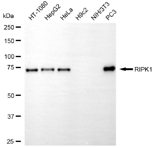[KD Validated] Anti-RIPK1 Rabbit mAb [40M66F58]