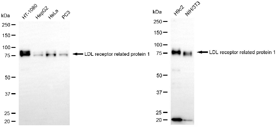 [KD Validated] Anti-LRP1 Rabbit mAb [17N34B26]