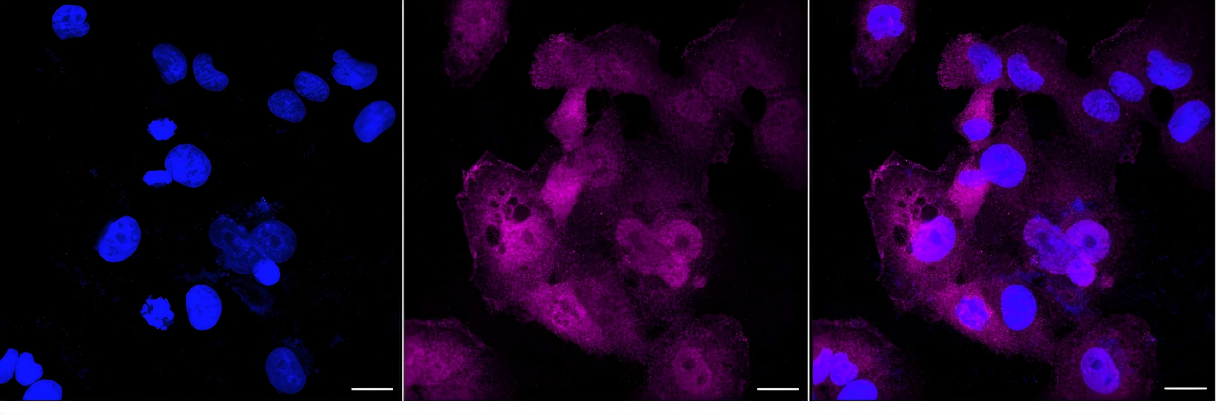 [KD Validated] Anti-PLCG1 Rabbit mAb [47H40S62]