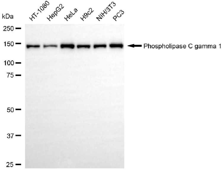 [KD Validated] Anti-PLCG1 Rabbit mAb [47H40S62]