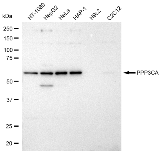 [KD Validated] Anti-PPP3CA Rabbit mAb [11T45J64]