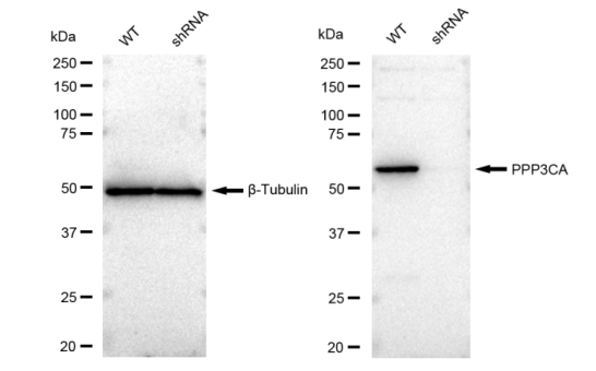 [KD Validated] Anti-PPP3CA Rabbit mAb [11T45J64]