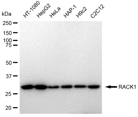 [KD Validated] Anti-RACK1 Rabbit mAb [48P17S82]
