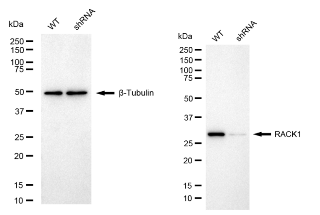[KD Validated] Anti-RACK1 Rabbit mAb [48P17S82]