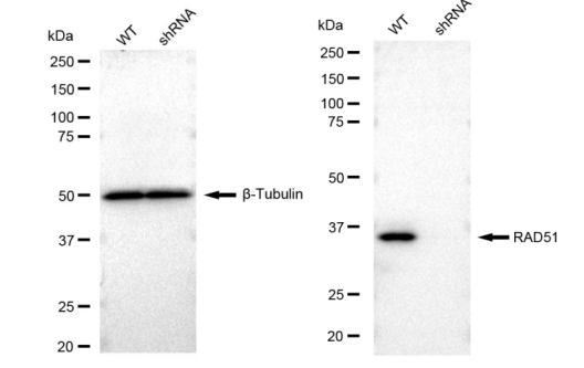 [KD Validated] Anti-RAD51 Rabbit mAb [14E13S93]