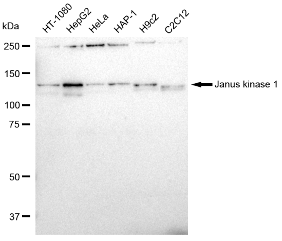 [KD Validated] Anti-JAK1 Rabbit mAb [18P44L51]