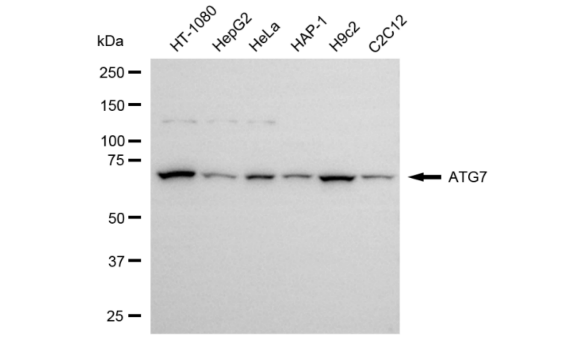 [KD Validated] Anti-ATG7 Rabbit mAb [68D13H15]
