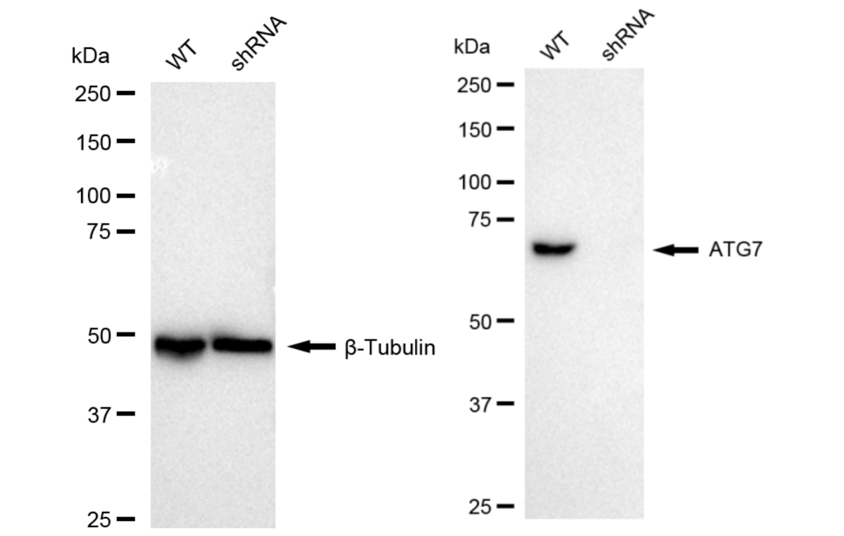 [KD Validated] Anti-ATG7 Rabbit mAb [68D13H15]