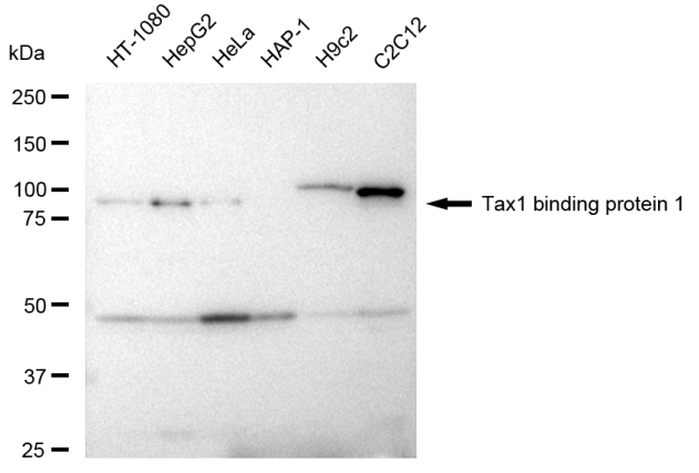 [KD Validated] Anti-TAX1BP1 Rabbit mAb [28F38A94]