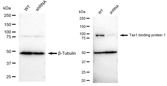 [KD Validated] Anti-TAX1BP1 Rabbit mAb [28F38A94]