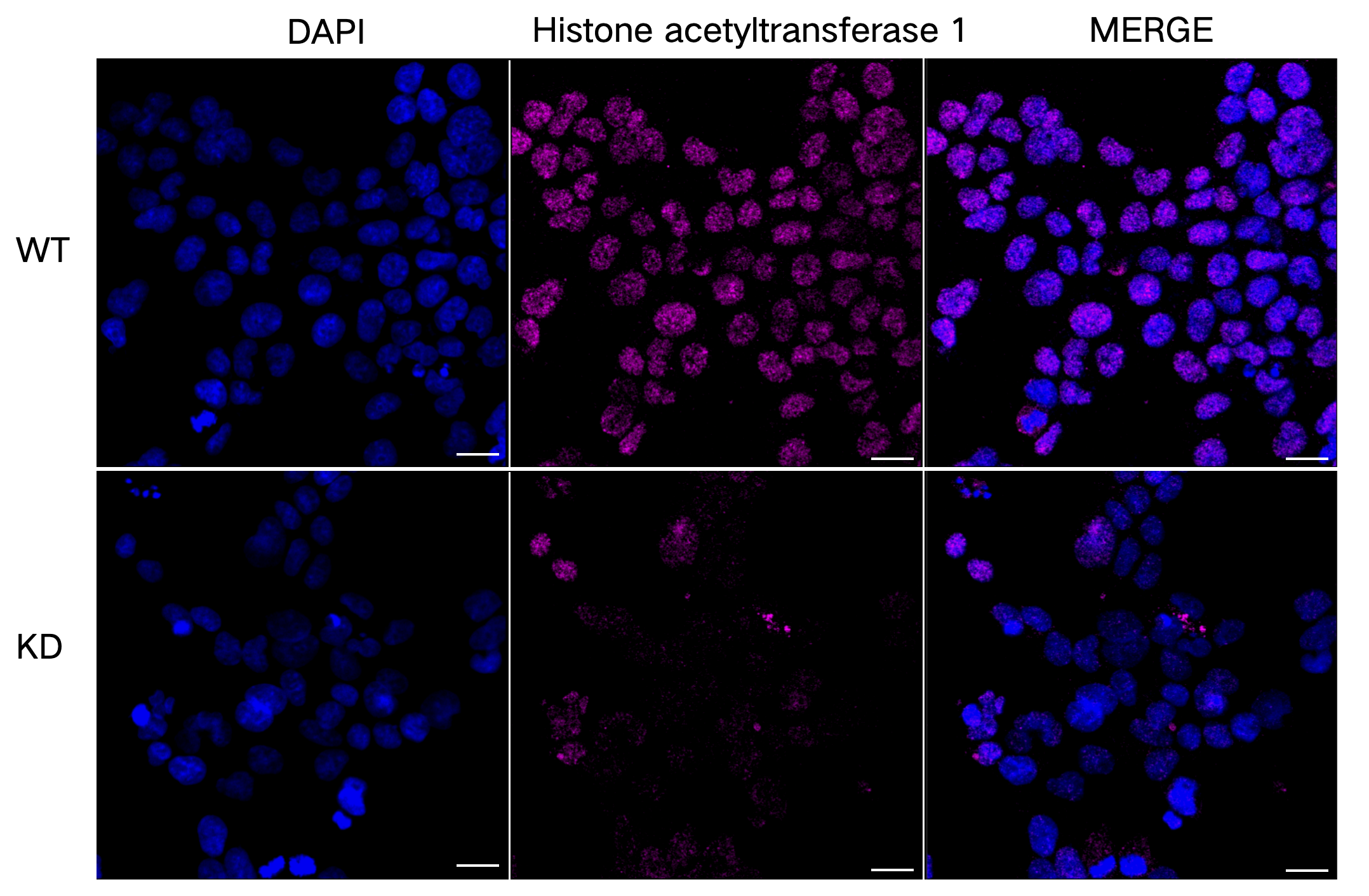 [KD Validated] Anti-HAT1 Rabbit mAb [77T45T67]