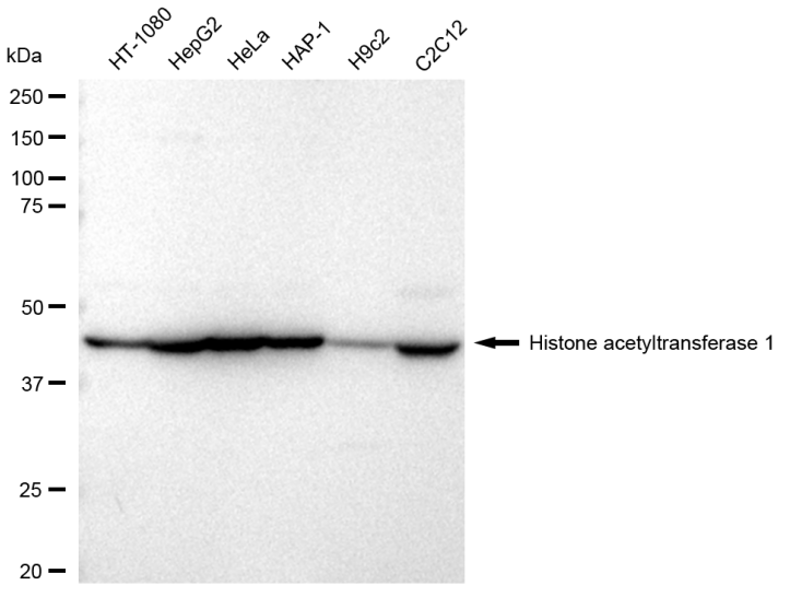 [KD Validated] Anti-HAT1 Rabbit mAb [77T45T67]