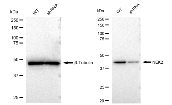 [KD Validated] Anti-NEK2 Rabbit mAb [83P91C53]