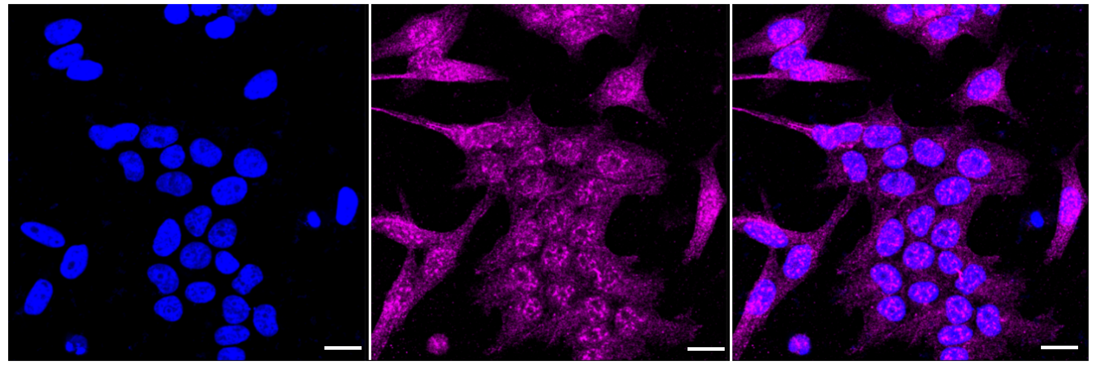 [KD Validated] Anti-RPS6KA1 Rabbit mAb [43S15S56]