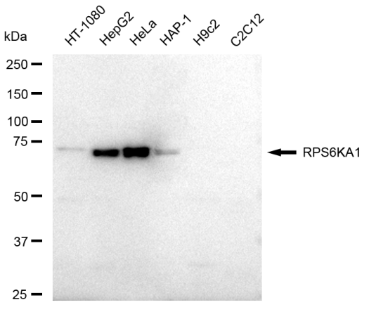 [KD Validated] Anti-RPS6KA1 Rabbit mAb [43S15S56]