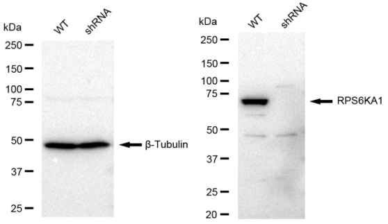 [KD Validated] Anti-RPS6KA1 Rabbit mAb [43S15S56]