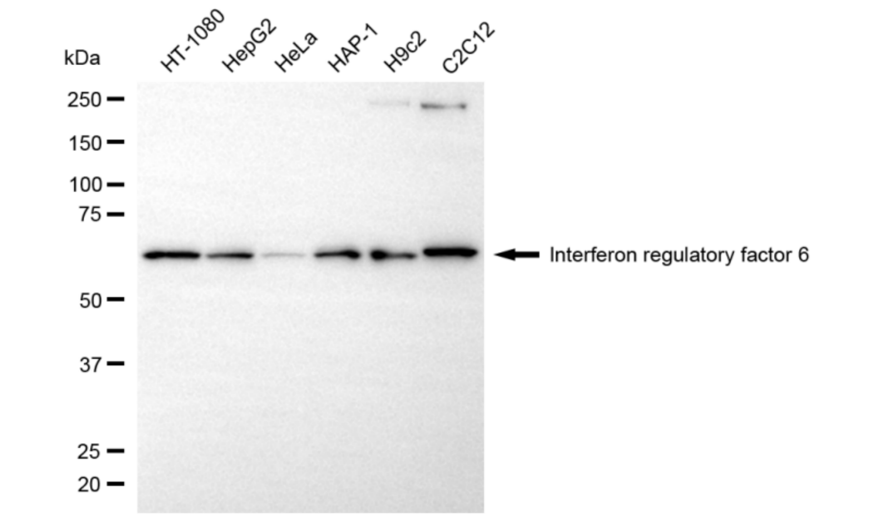 [KD Validated] Anti-IRF6 Rabbit mAb [17T39G24]
