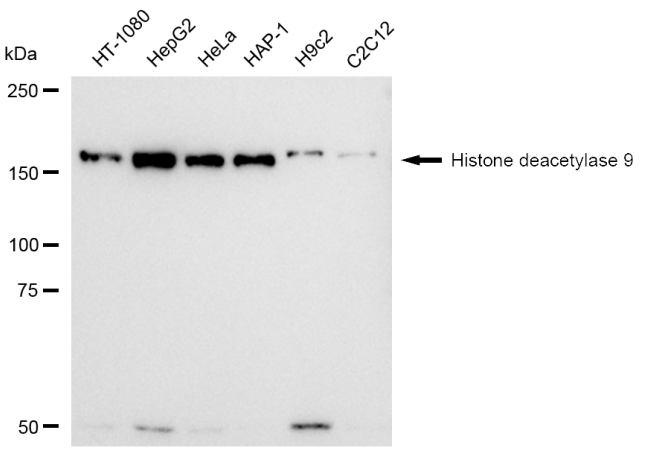 [KD Validated] Anti-HDAC9 Rabbit mAb [78P50B87]