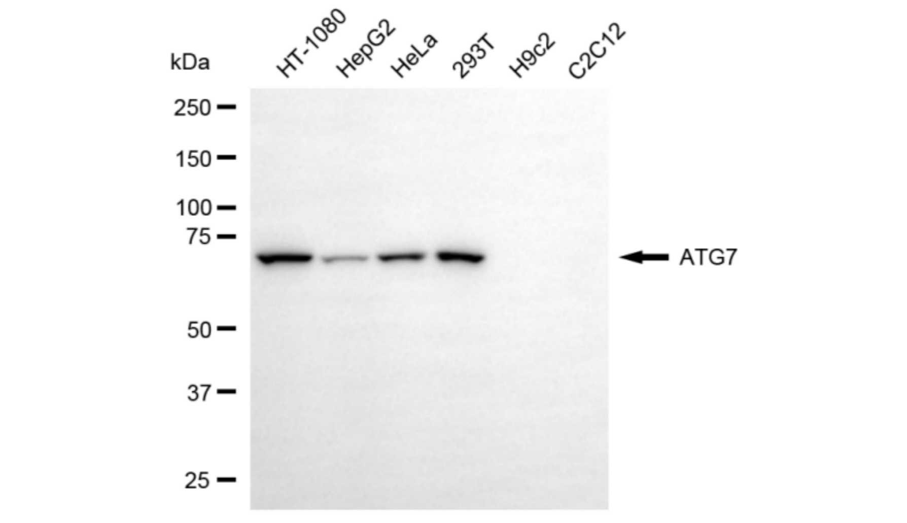 [KD Validated] Anti-ATG7 Rabbit mAb [18P51L70]