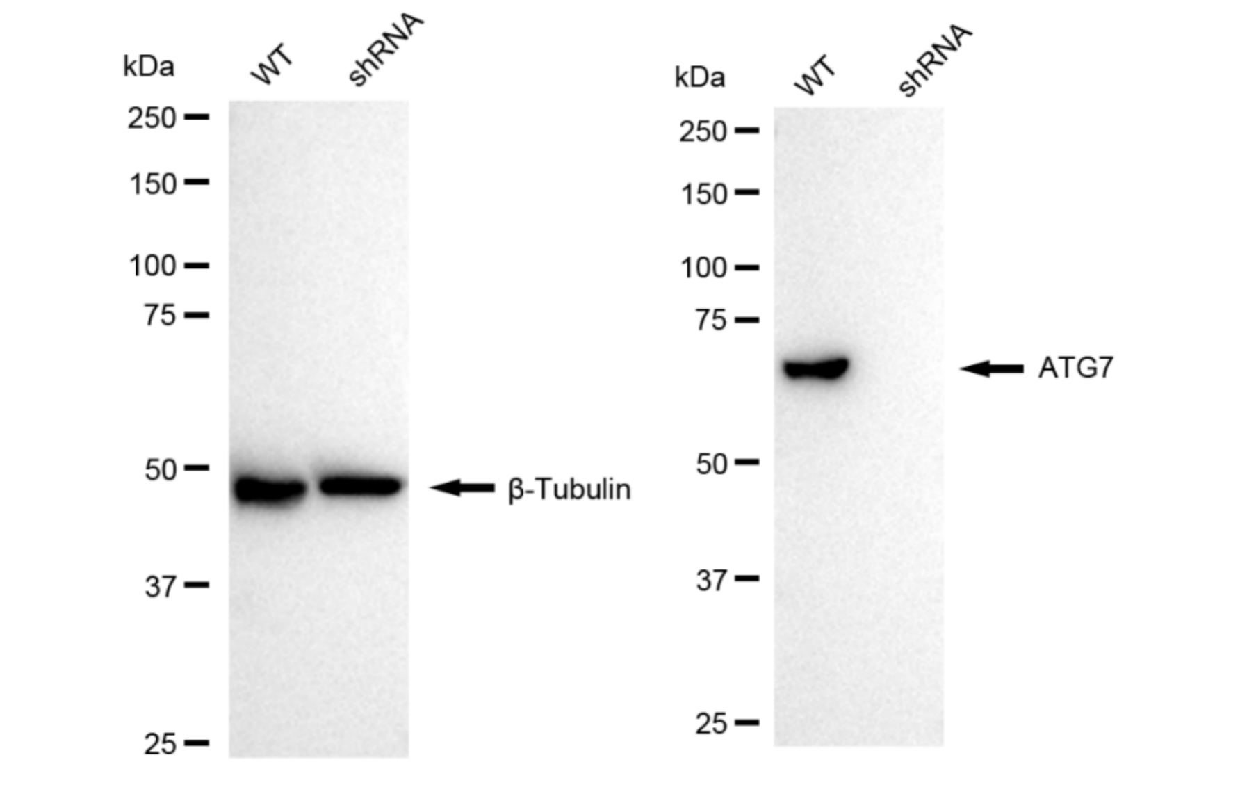 [KD Validated] Anti-ATG7 Rabbit mAb [18P51L70]