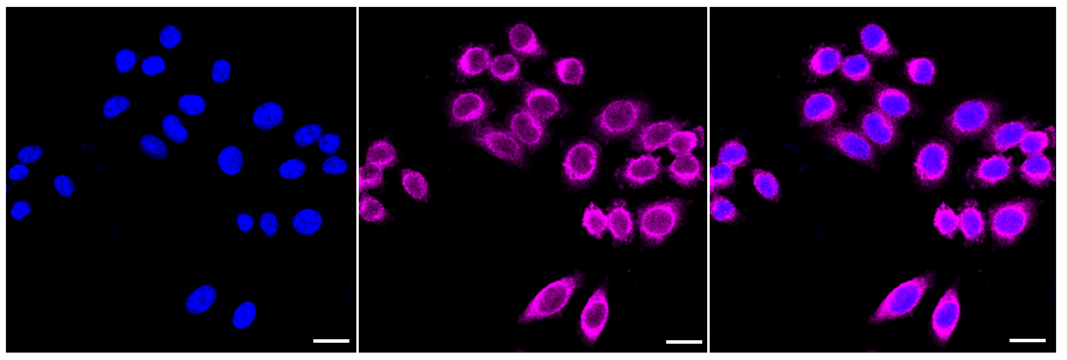 [KD Validated] Anti-ROCK2 Rabbit mAb [92L07O20]