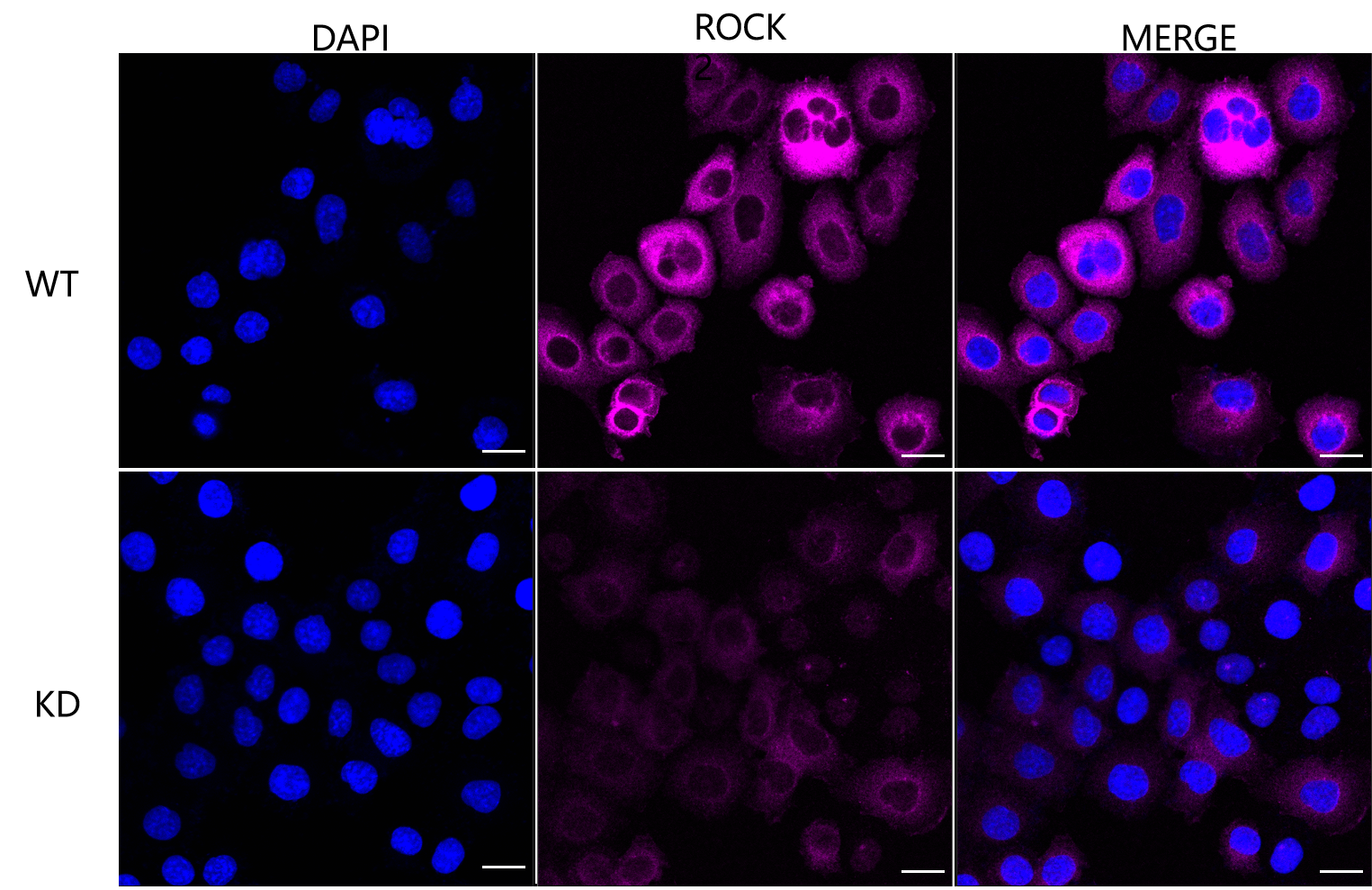 [KD Validated] Anti-ROCK2 Rabbit mAb [92L07O20]