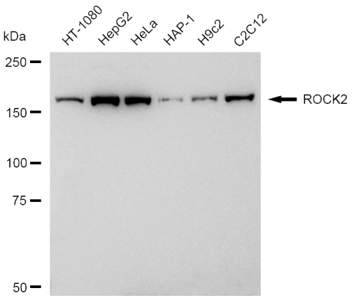 [KD Validated] Anti-ROCK2 Rabbit mAb [92L07O20]