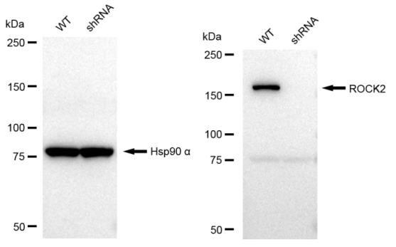 [KD Validated] Anti-ROCK2 Rabbit mAb [92L07O20]