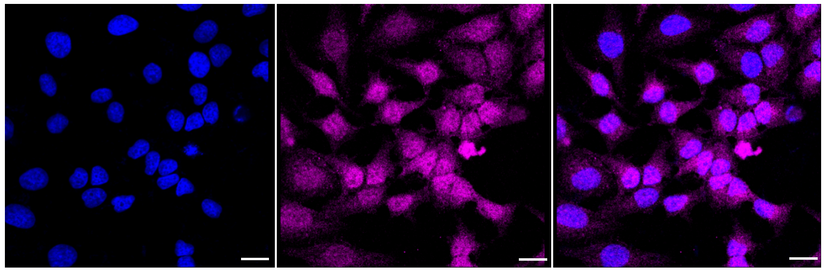 [KD Validated] Anti-CDKN2C Rabbit mAb [74B91A30]