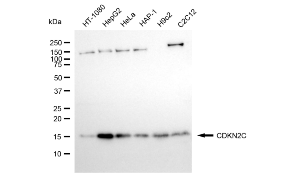 [KD Validated] Anti-CDKN2C Rabbit mAb [74B91A30]