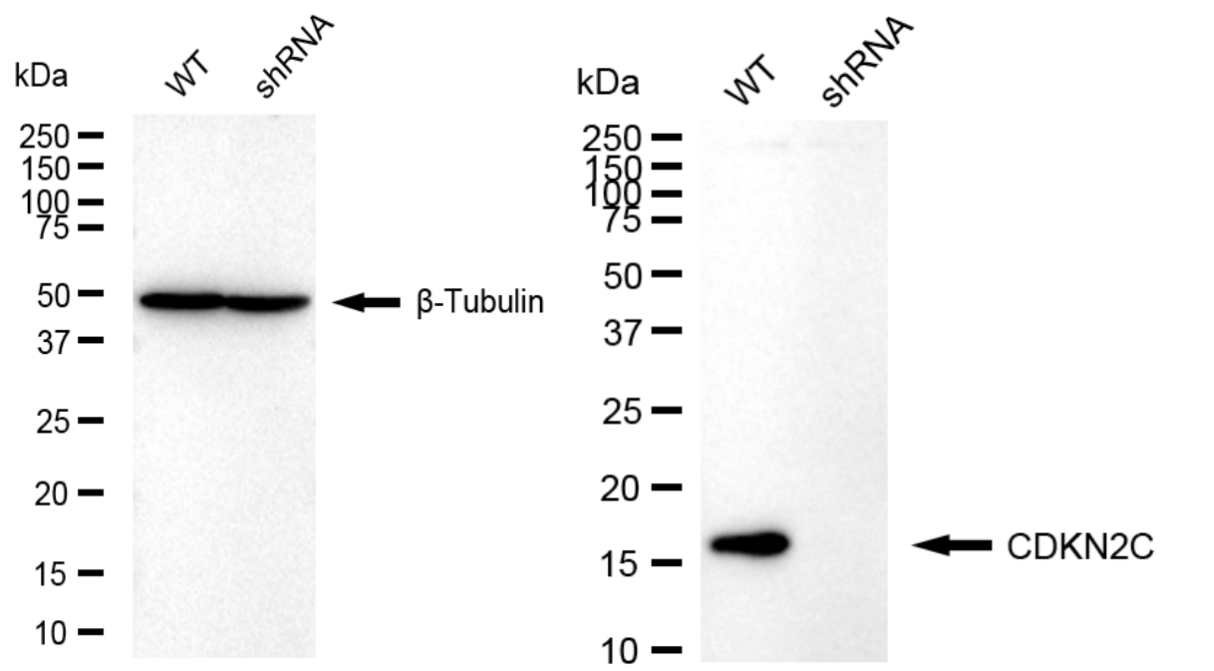 [KD Validated] Anti-CDKN2C Rabbit mAb [74B91A30]