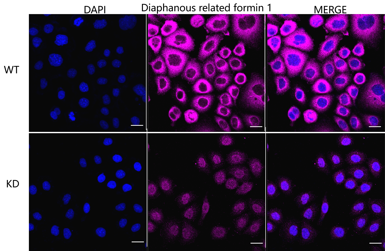 [KD Validated] Anti-DIAPH1 Rabbit mAb [71Q05B45]