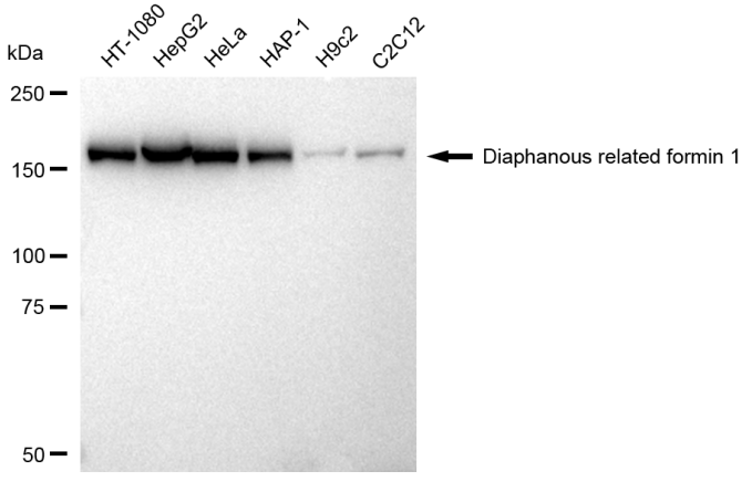 [KD Validated] Anti-DIAPH1 Rabbit mAb [71Q05B45]