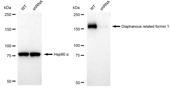 [KD Validated] Anti-DIAPH1 Rabbit mAb [71Q05B45]
