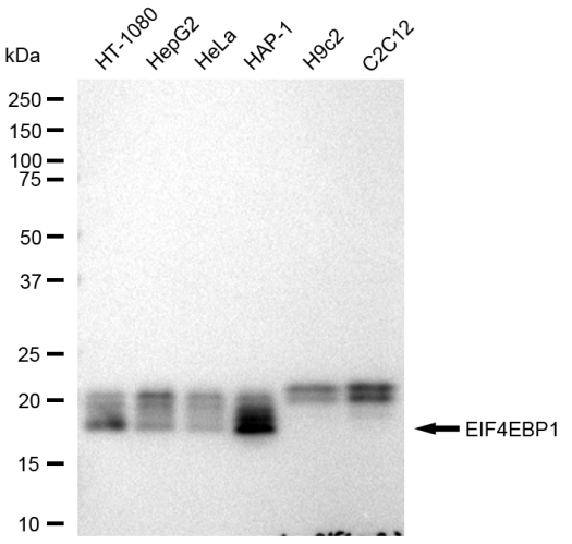 [KD Validated] Anti-EIF4EBP1 Rabbit mAb [14F54T66]