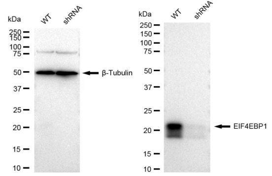 [KD Validated] Anti-EIF4EBP1 Rabbit mAb [14F54T66]
