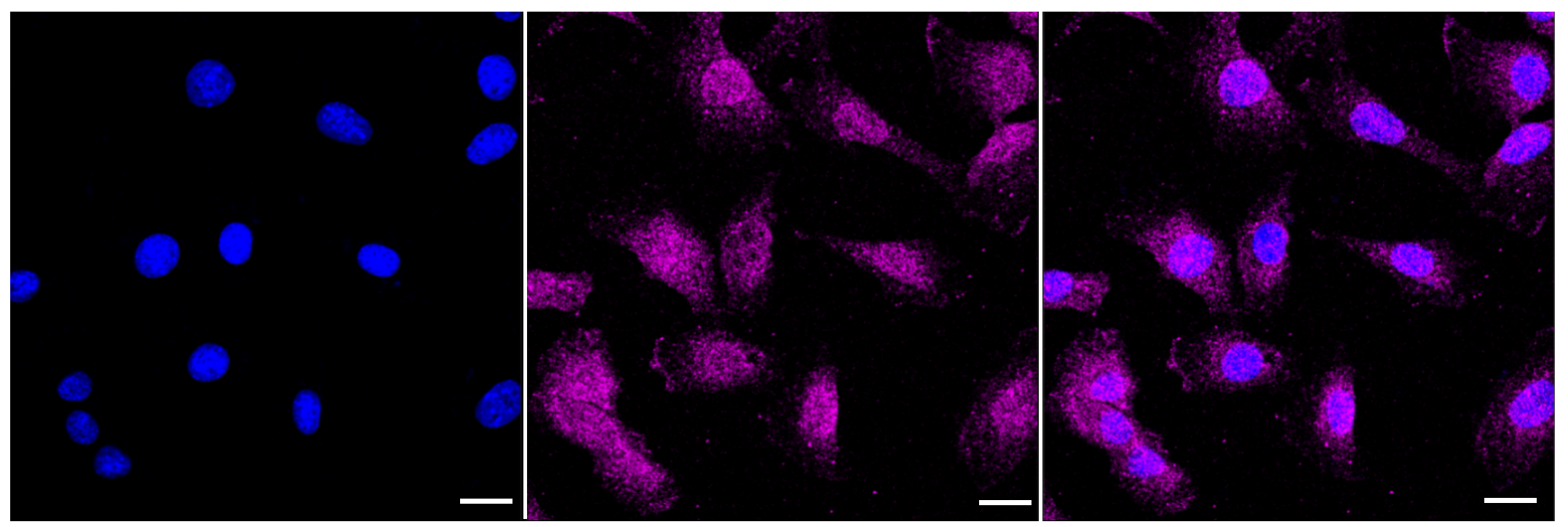 [KD Validated] Anti-MAP1LC3A Rabbit mAb [12G07Q86]