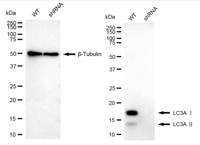 [KD Validated] Anti-MAP1LC3A Rabbit mAb [12G07Q86]